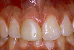 Southdale Dental Kingston, Jamaica West Indies Southdale Dental Kingston, Jamaica West Indies